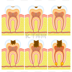 牙齿结构图片_牙齿的内部结构