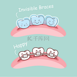 隐形牙套卡通牙