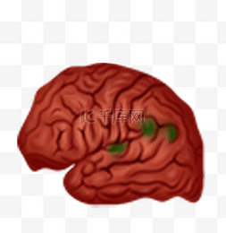 人体医疗组织器官大脑