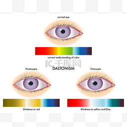 眼睛测试图片_色盲