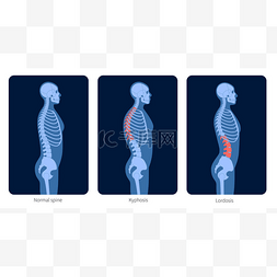 脊柱解剖图片_脊柱 x 射线