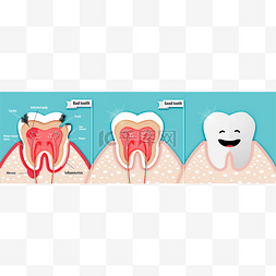 关于坏牙齿和好牙齿载体的健康科