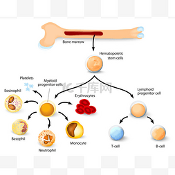 多发性骨髓瘤图片_造血干细胞