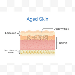 老年的皮肤层在 3d 矢量风格.