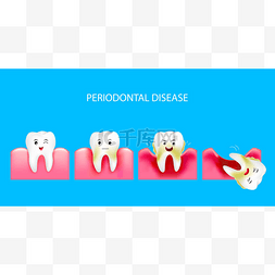牙周疾病的一步。健康的牙齿和牙