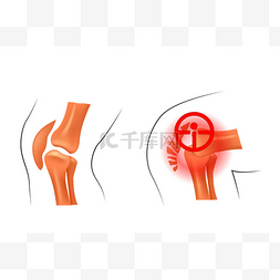 膝关节脱位、 骨折。骨伤科和骨