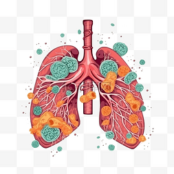 哮喘日红色肺部