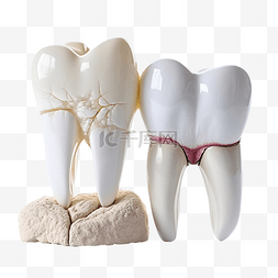 白色牙齿图片_蛀牙和牙医