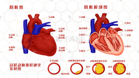 人体器官心脏解剖图及冠状动脉粥样硬化发展