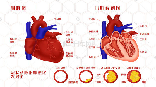人体部头线稿插画图片_人体器官心脏解剖图及冠状动脉粥样硬化发展