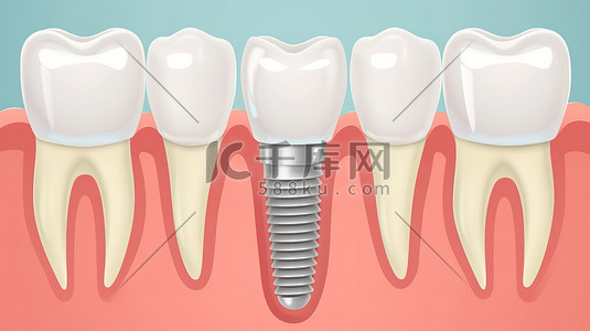 种植牙特写平面插画